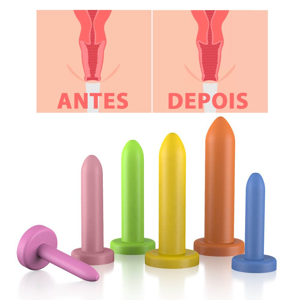 Kit de Dilatador Vaginal Graduados Liso 6 Unidades | Foto 01